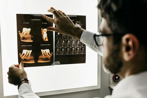Cotisations de l'orthophoniste libéral en 2026 : URSSAF, CARPIMKO et calcul