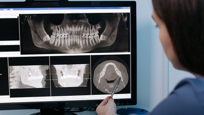 Pourquoi créer une SPFPL pour votre cabinet dentaire ?
