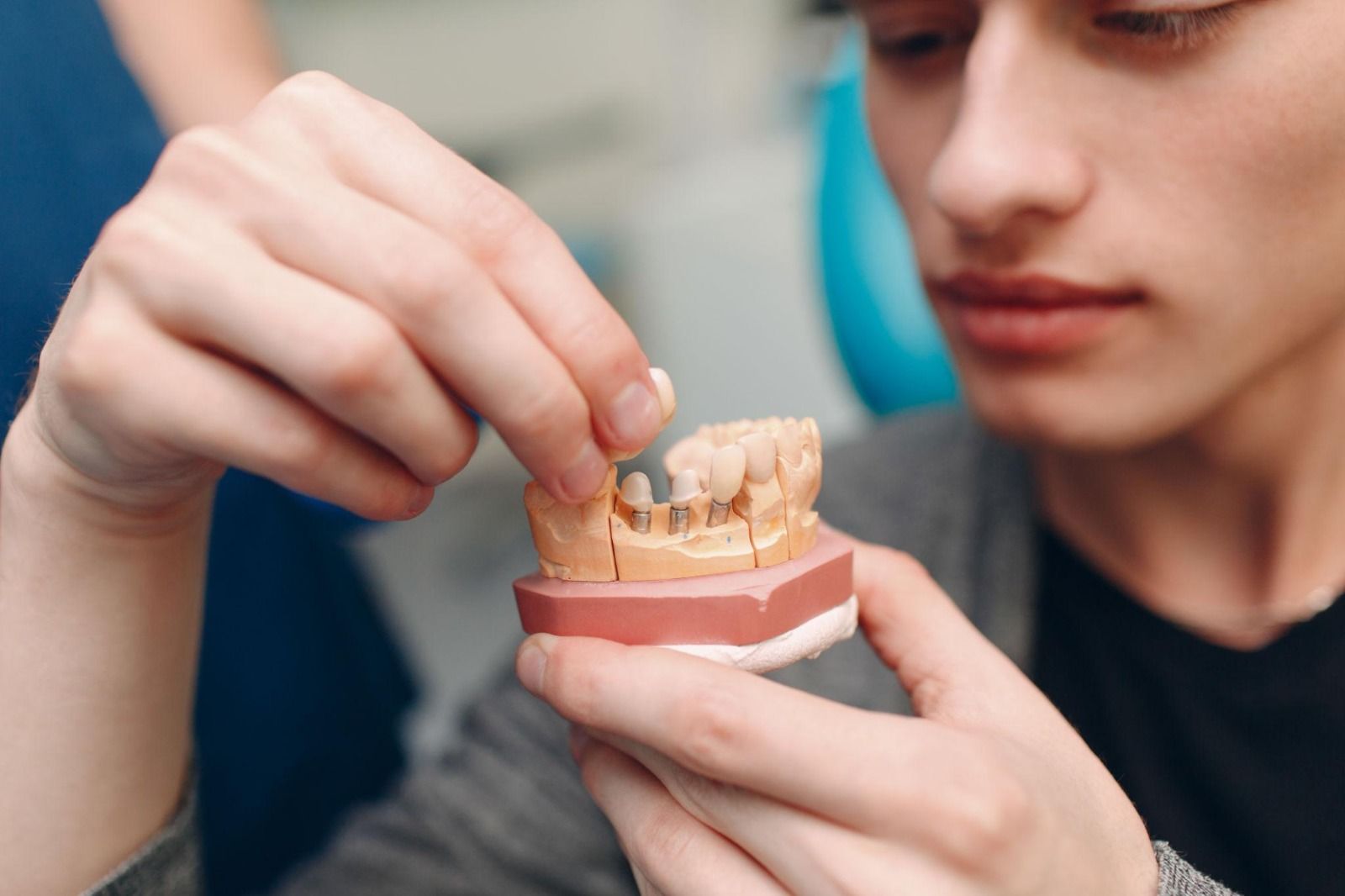 Dental Implants