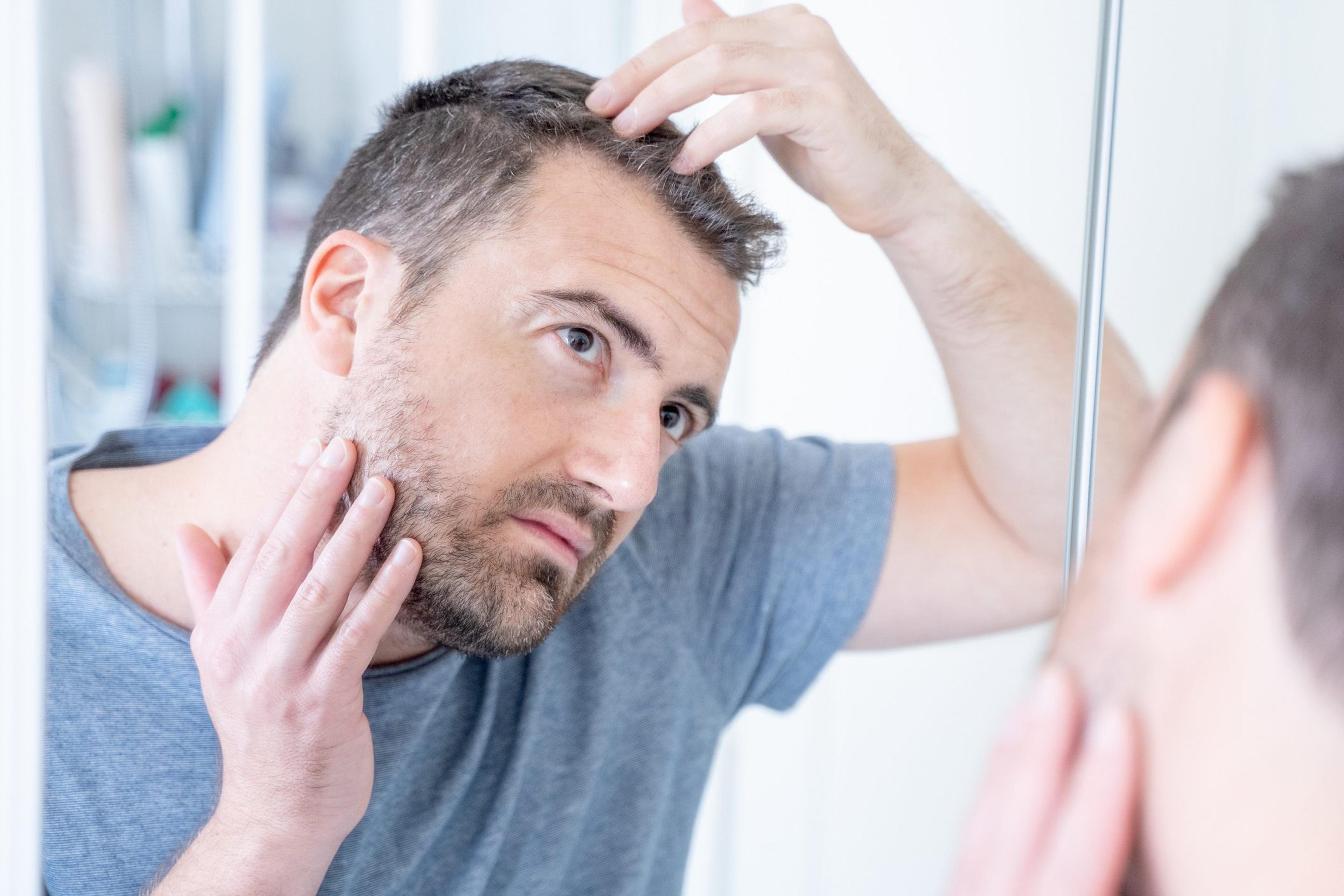 Psoriasis most commonly affects the knees, elbows, trunk, and scalp, but between 45 and 56% of people living with psoriasis have scalp psoriasis, according to the National Psoriasis Foundation.