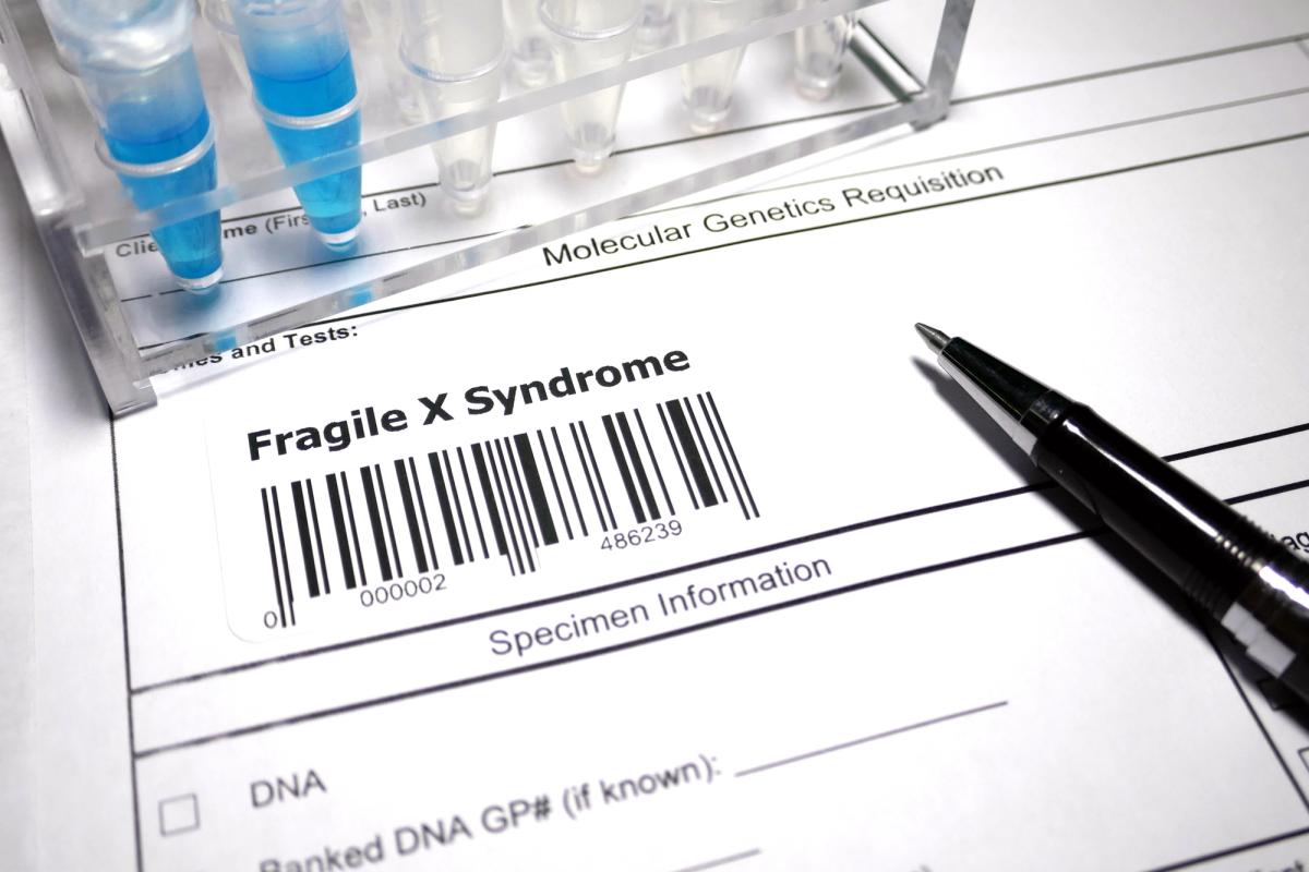 what-is-fragile-x-syndrome