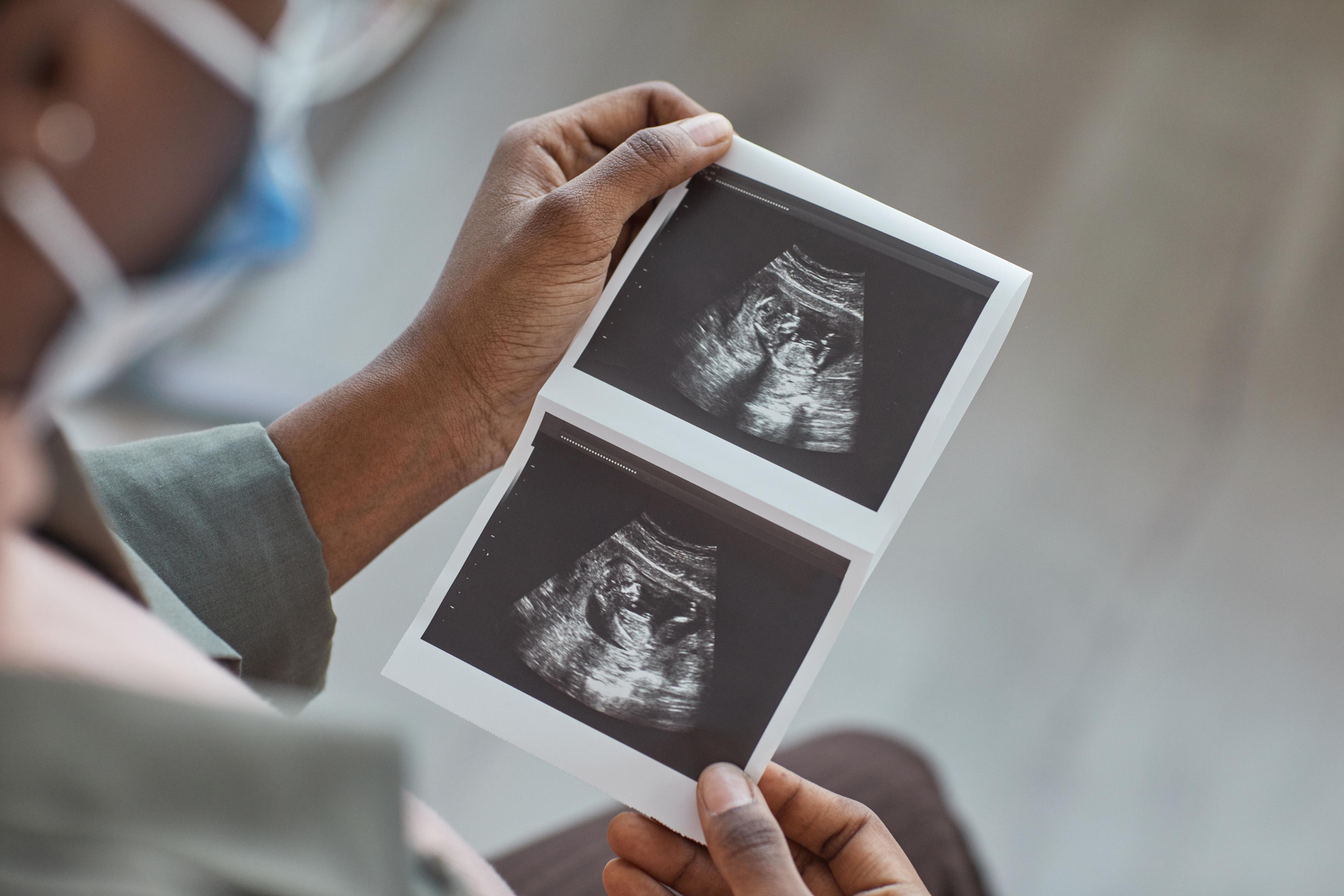 pregnant woman holds ultrasound image of baby