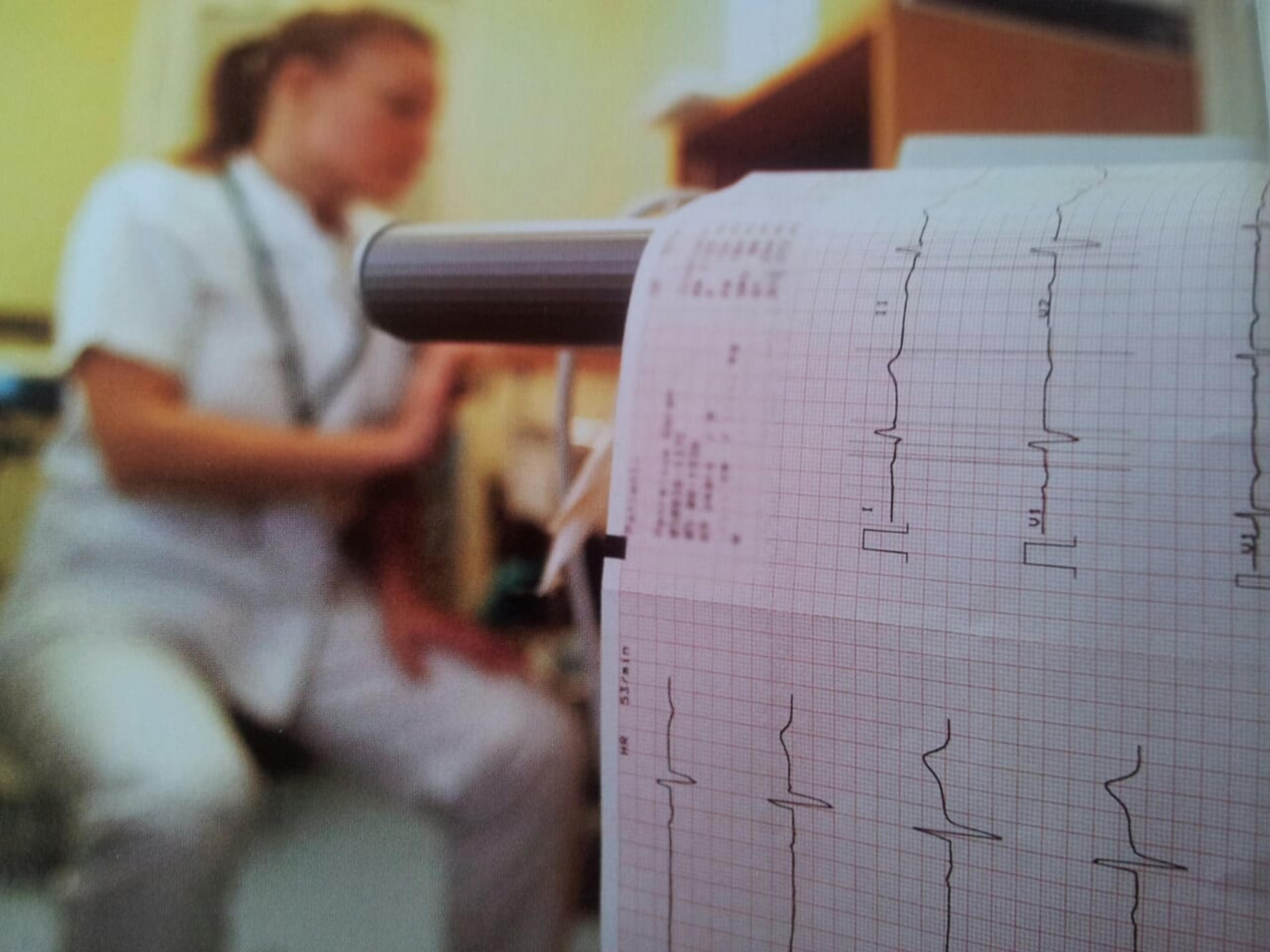 EKG heart test results printing