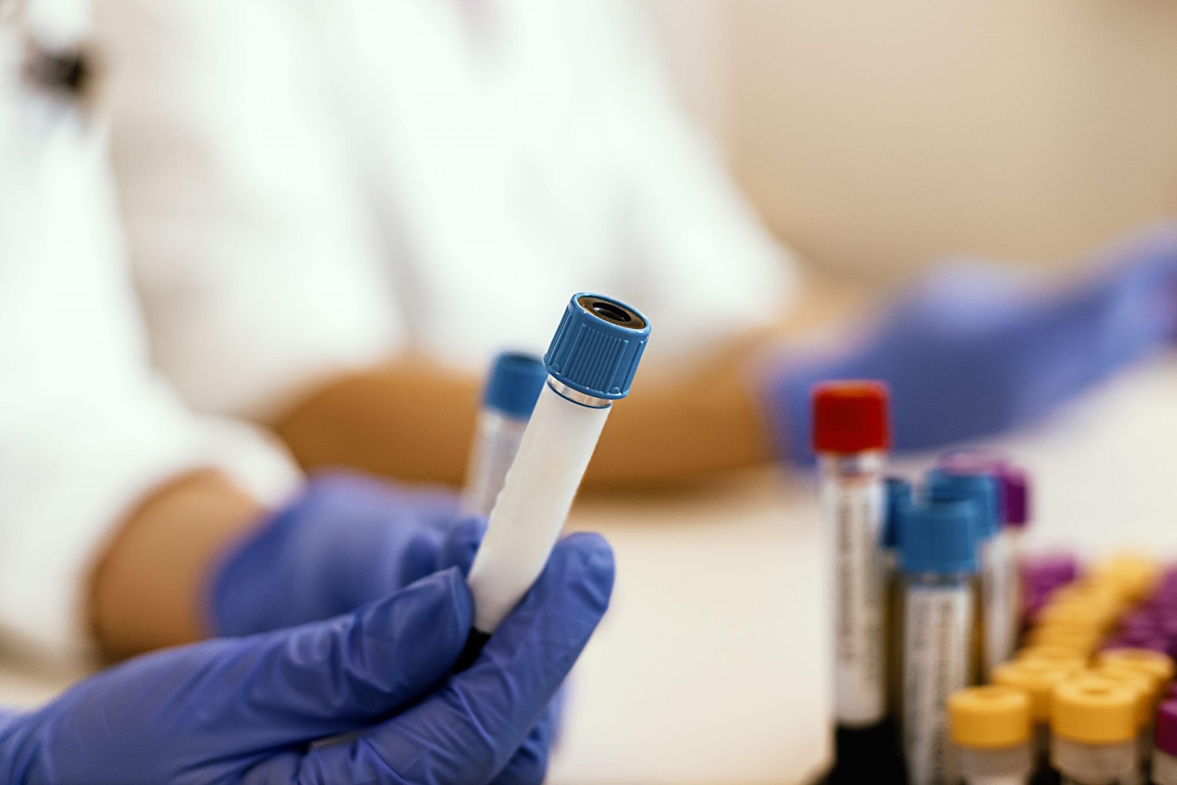 Gloved hand holding blood samples.