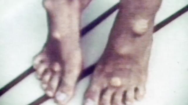 Surfer's knots, early 1960s