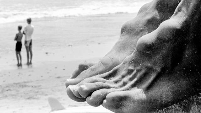 Kemp Aaberg's foot knots. Photo: Ron Stoner / SURFER