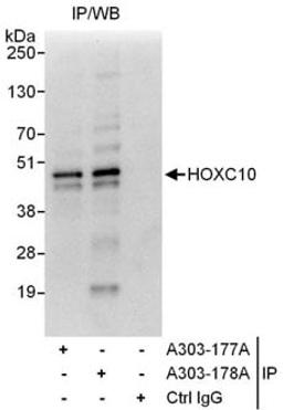 Detection of human HOXC10 by western blot of immunoprecipitates.