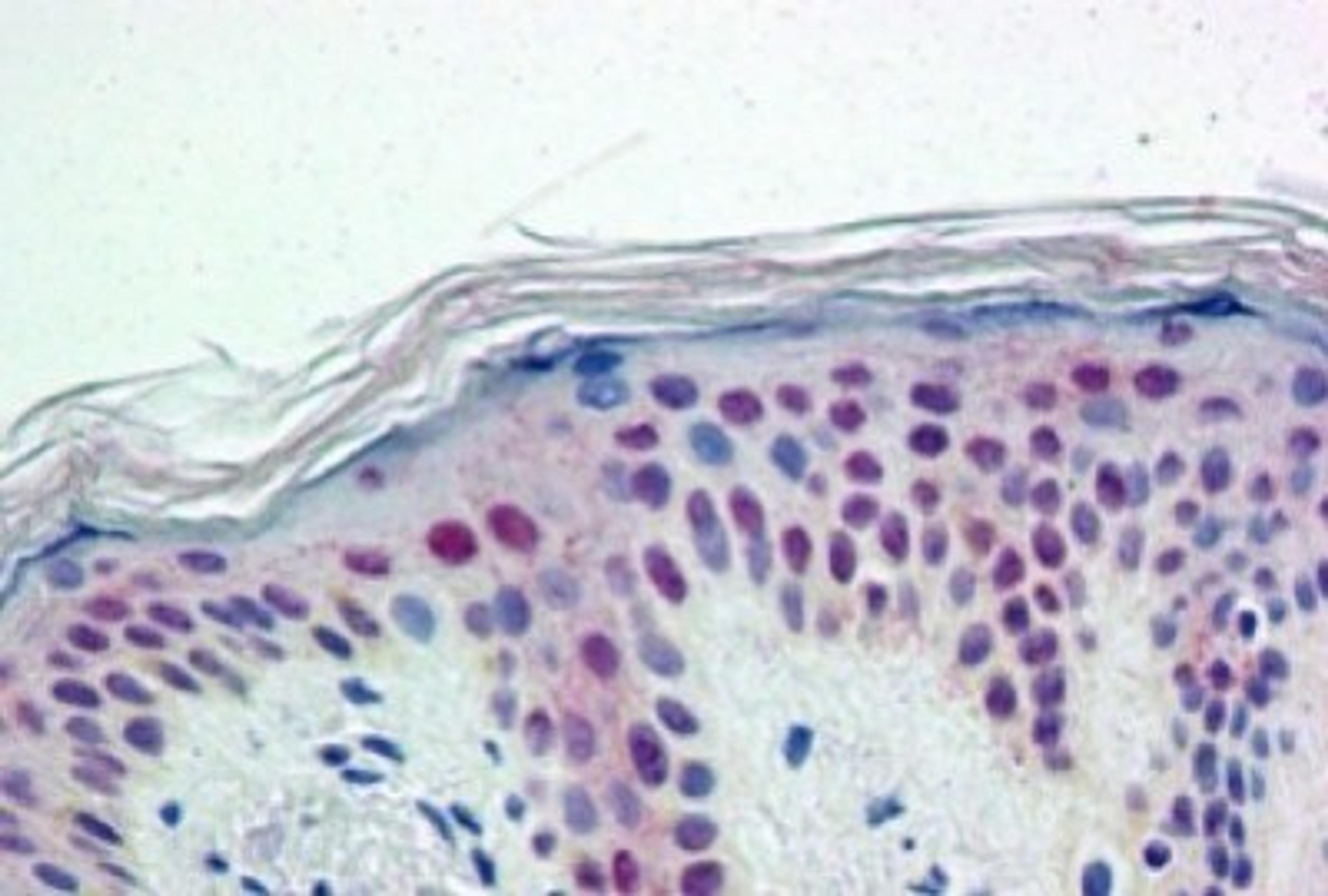 Immunohistochemistry-Paraffin: PTBP1 Antibody [NB100-1310] - (5ug/ml) staining of paraffin embedded Human Skin. Steamed antigen retrieval with citrate buffer pH 6, AP-staining.