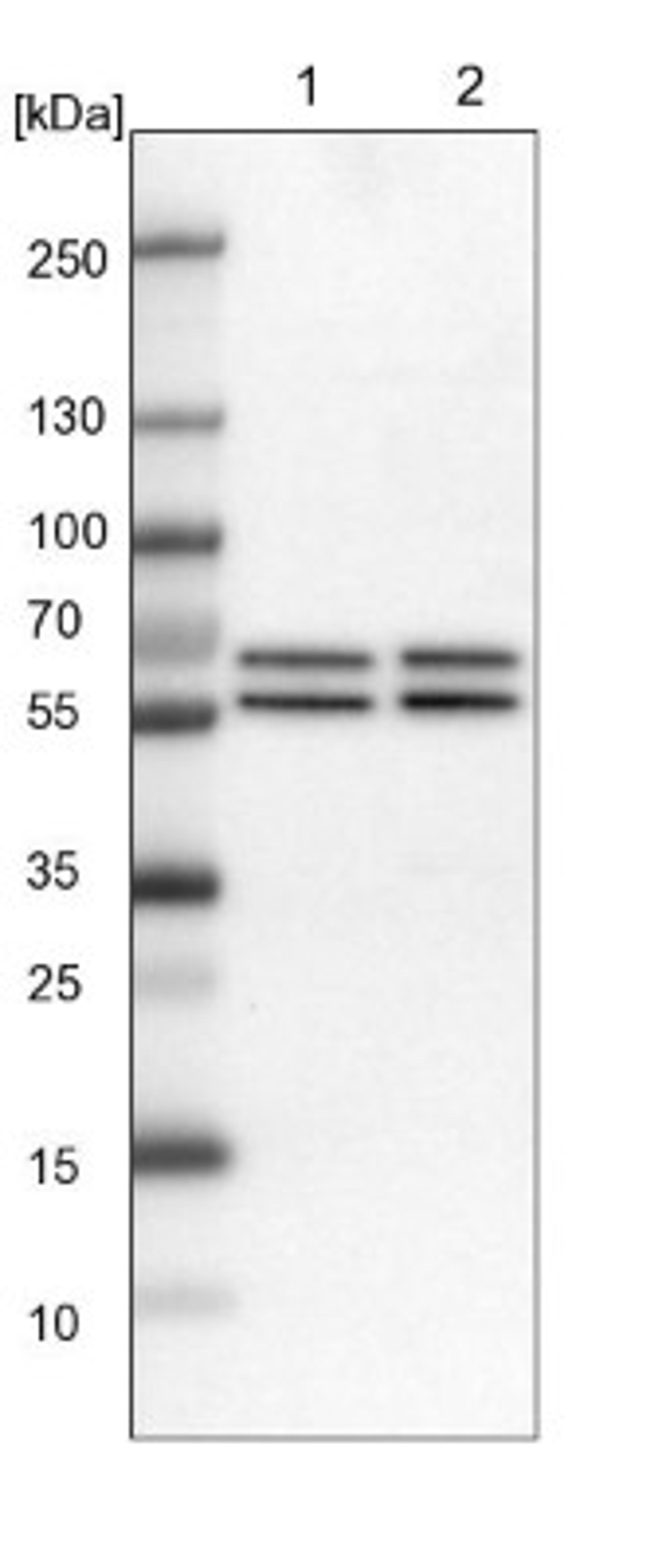 Western Blot: API5 Antibody [NBP1-89326] - Lane 1: NIH-3T3 cell lysate (Mouse embryonic fibroblast cells)<br/>Lane 2: NBT-II cell lysate (Rat Wistar bladder tumour cells)