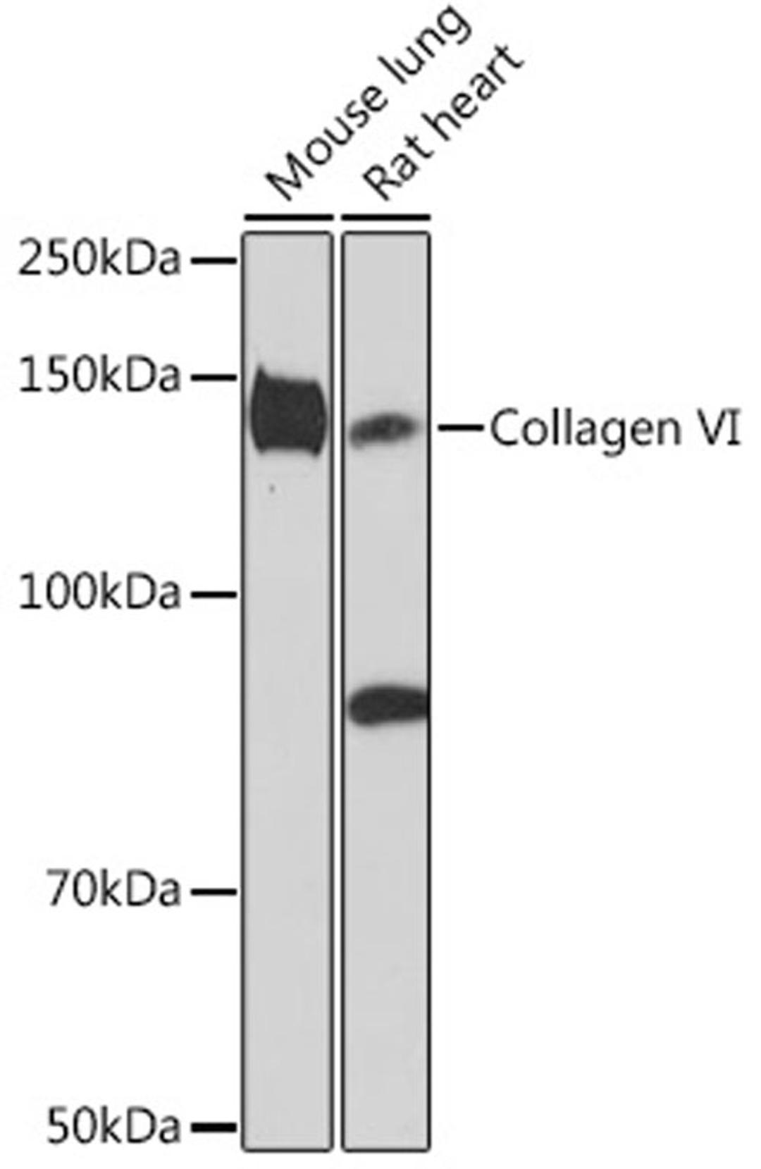 Western blot - Collagen VI Rabbit mAb (A9738)