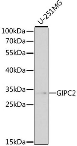 Western blot - GIPC2 antibody (A1225)