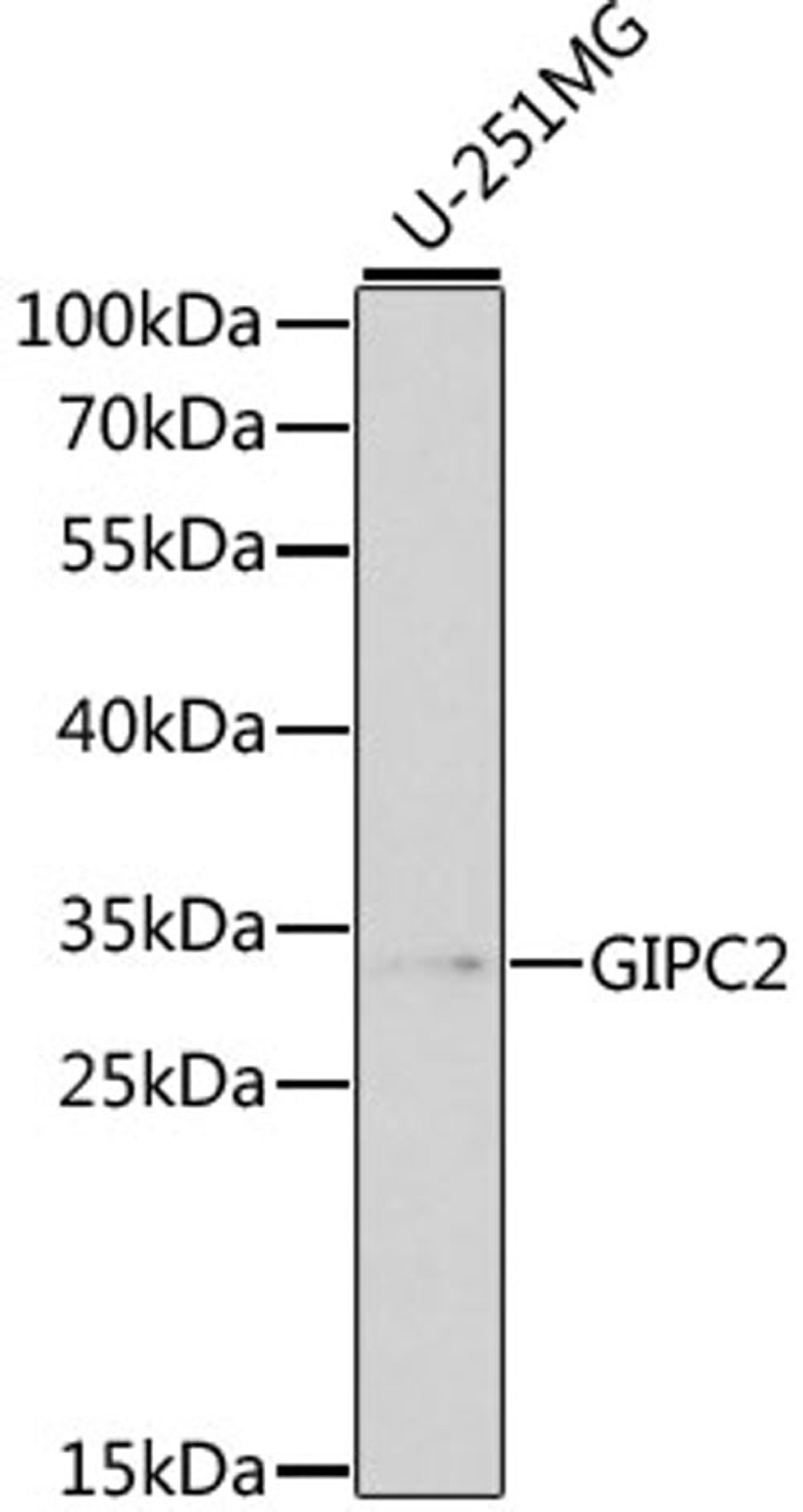 Western blot - GIPC2 antibody (A1225)