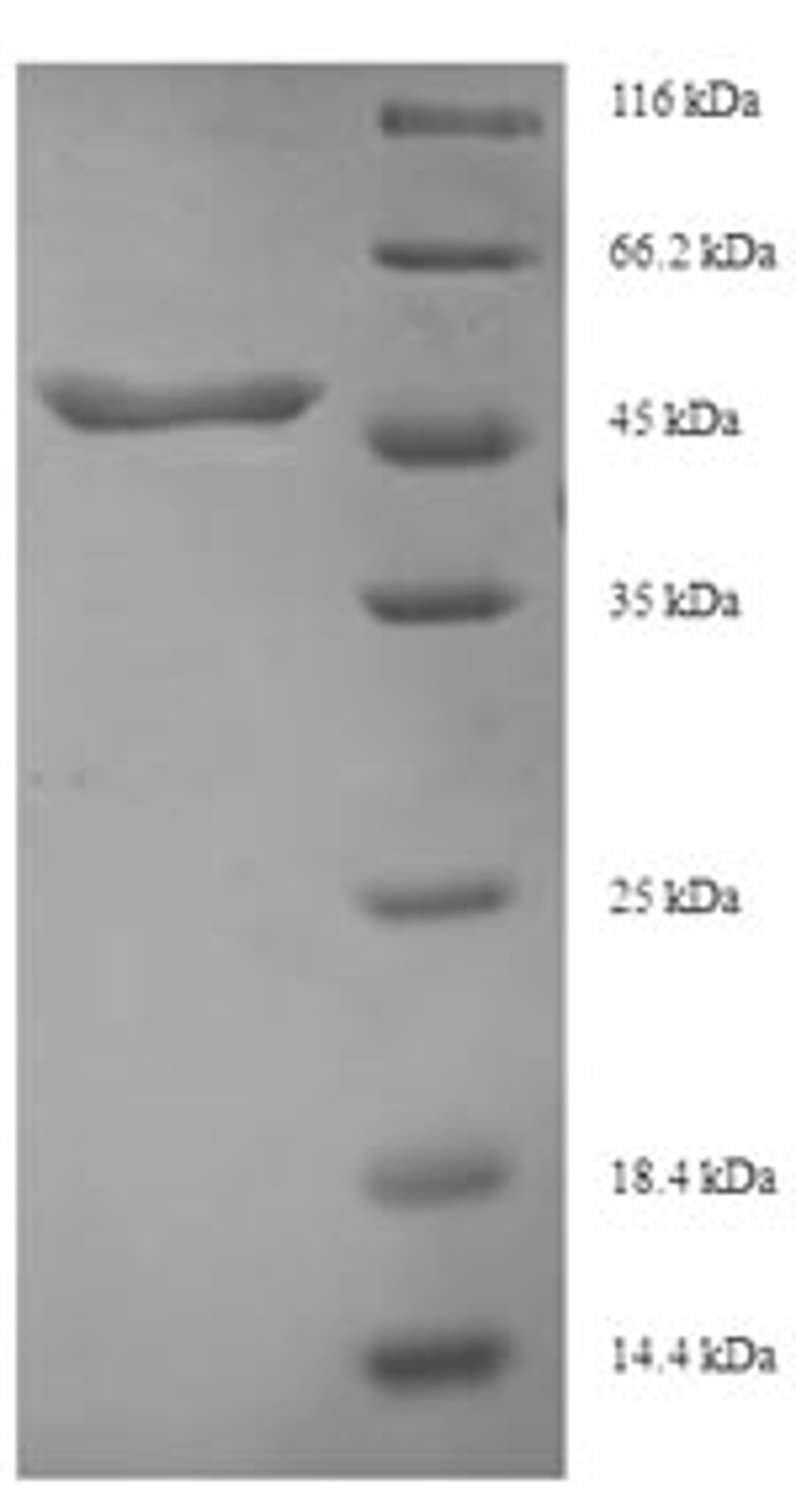 (Tris-Glycine gel) Discontinuous SDS-PAGE (reduced) with 5% enrichment gel and 15% separation gel.