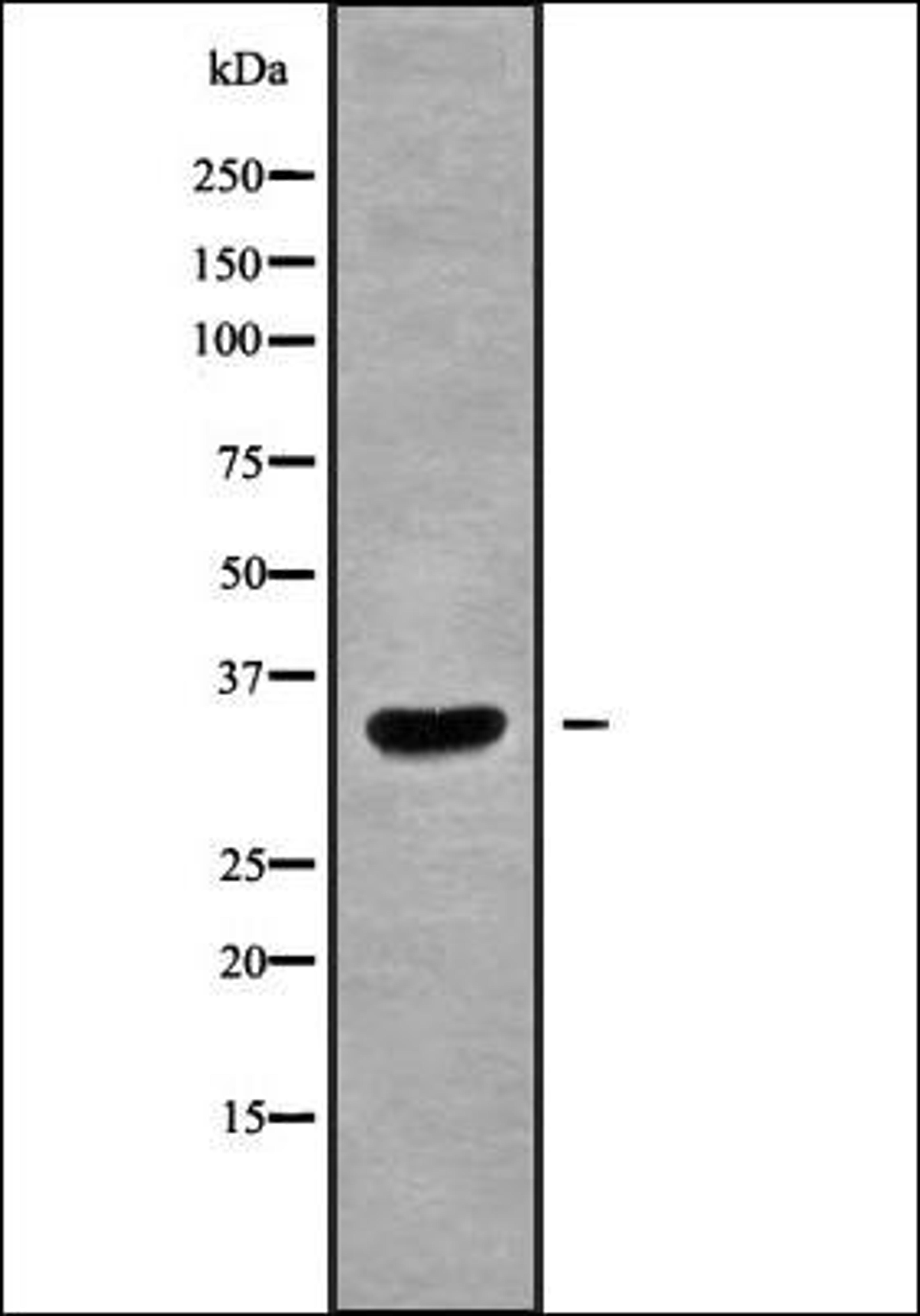 Western blot analysis of 293 whole cell lysates using AGPAT1 antibody