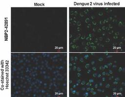 Immunocytochemistry/Immunofluorescence: NS2B Antibody [NBP2-42891] - Analysis of Samples: BHK-21 cells mock (left) and infected with Dengue virus 3 (right) were fixed in MeOH. Green: NS2B (Dengue virus) protein stained by NS2B (Dengue virus) antibody diluted at 1:2000. Blue: Hoechst 33342 staining.