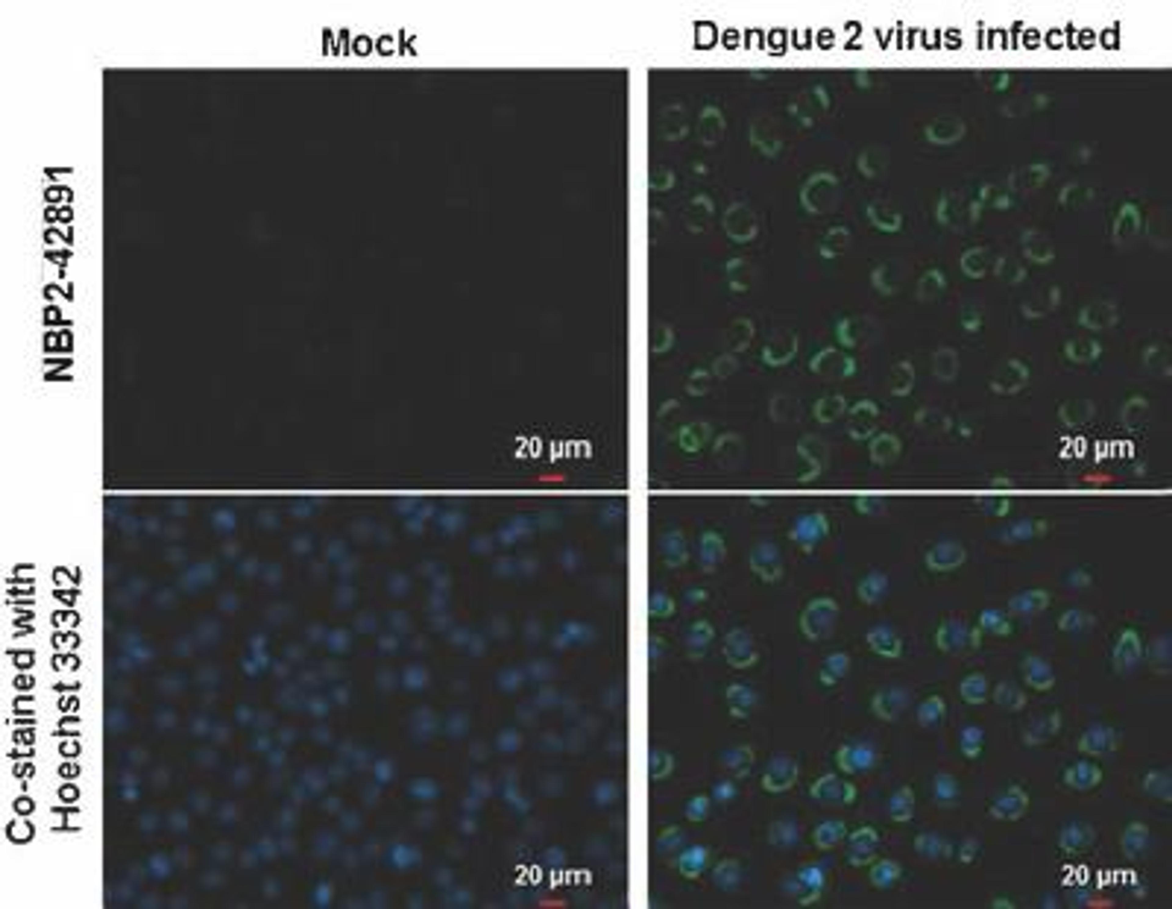 Immunocytochemistry/Immunofluorescence: NS2B Antibody [NBP2-42891] - Analysis of Samples: BHK-21 cells mock (left) and infected with Dengue virus 3 (right) were fixed in MeOH. Green: NS2B (Dengue virus) protein stained by NS2B (Dengue virus) antibody diluted at 1:2000. Blue: Hoechst 33342 staining.