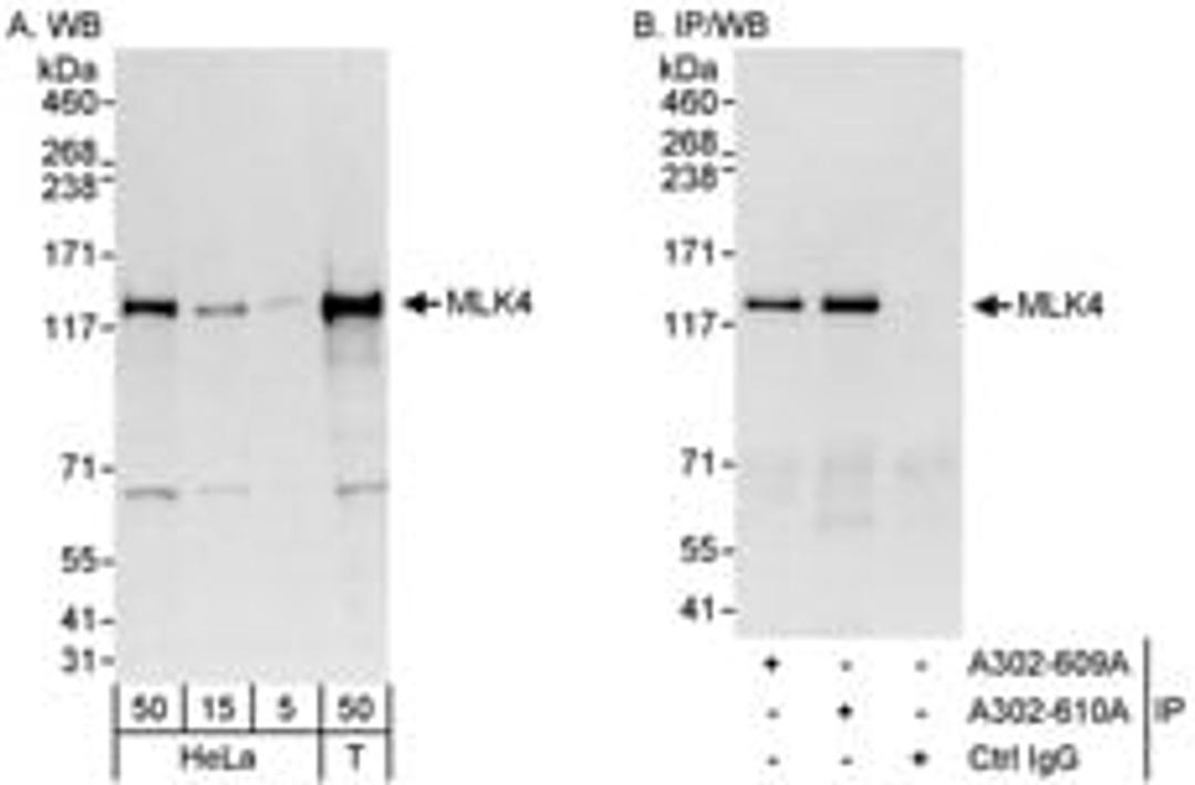 Detection of human MLK4 by western blot and immunoprecipitation.