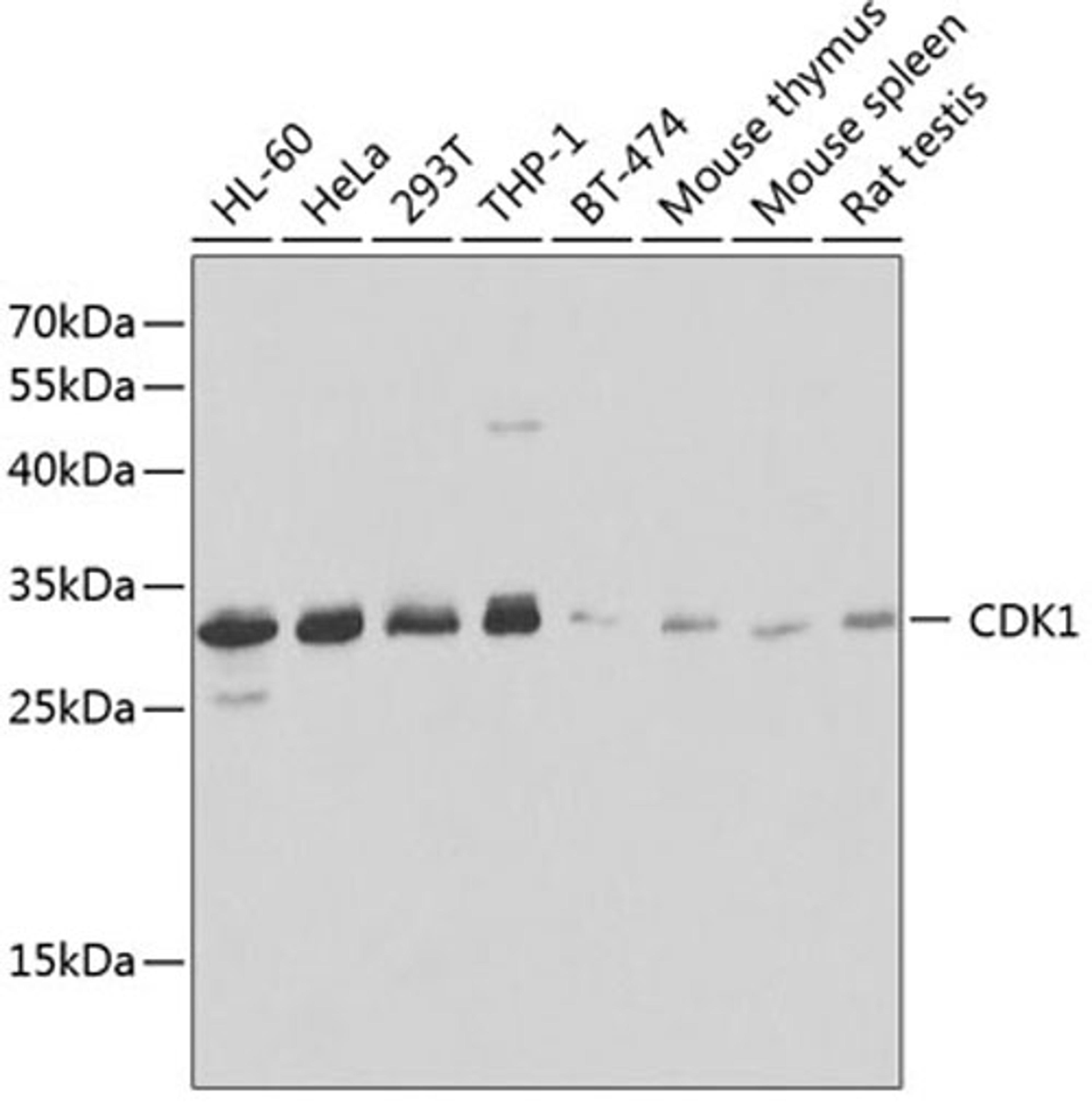 Western blot - CDK1 antibody (A0220)