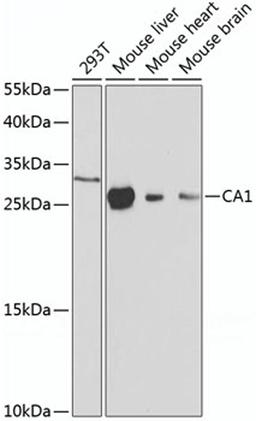 Western blot - CA1 antibody (A1031)