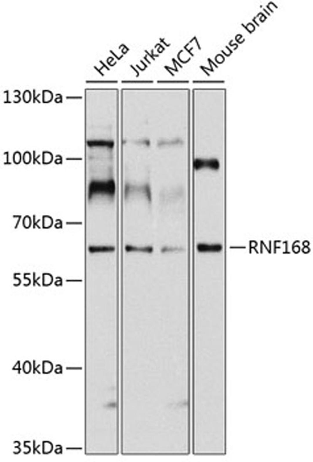 Western blot - RNF168 antibody (A3556)