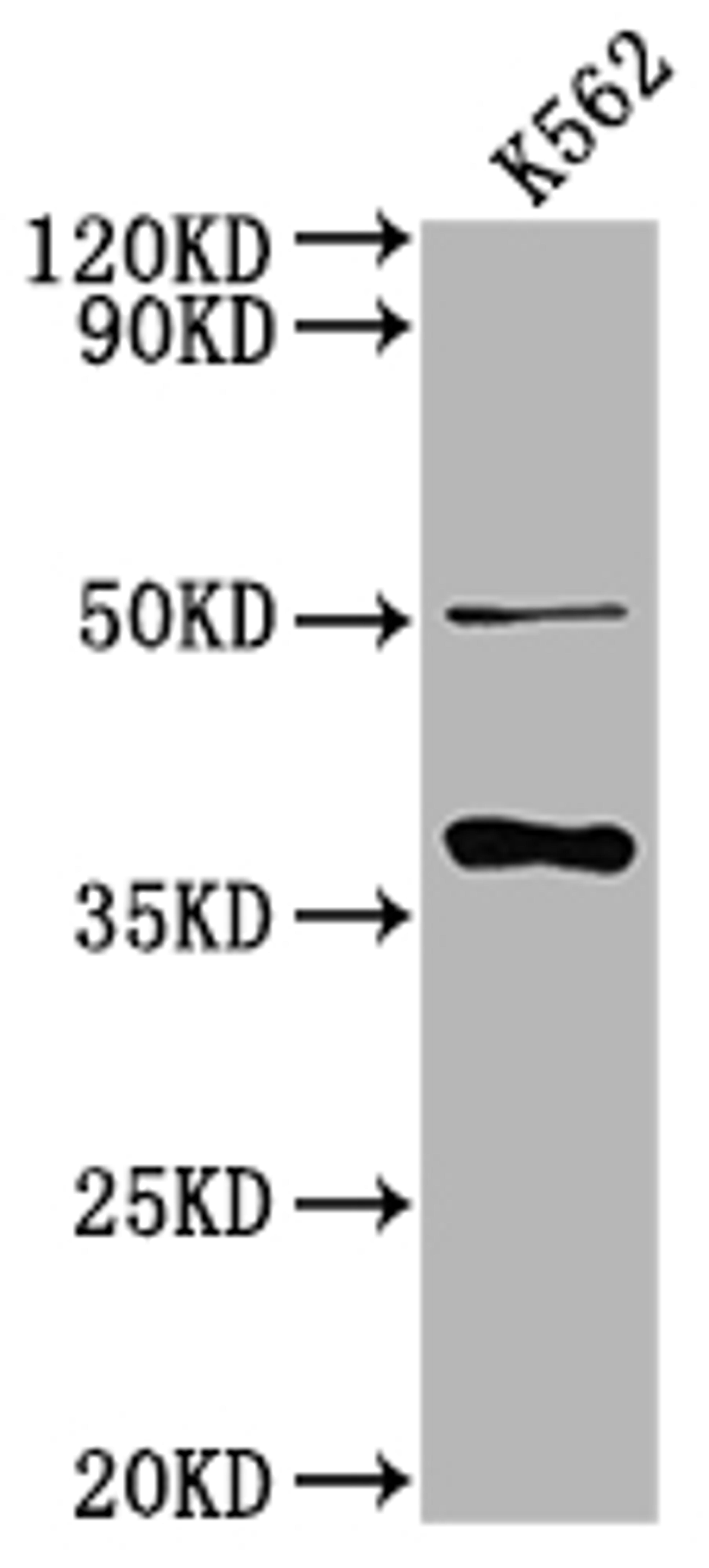 Western Blot. Positive WB detected in: K562 whole cell lysate. All lanes: OR5R1 antibody at 1:2000. Secondary. Goat polyclonal to rabbit IgG at 1/50000 dilution. Predicted band size: 37 kDa. Observed band size: 37 kDa. 
