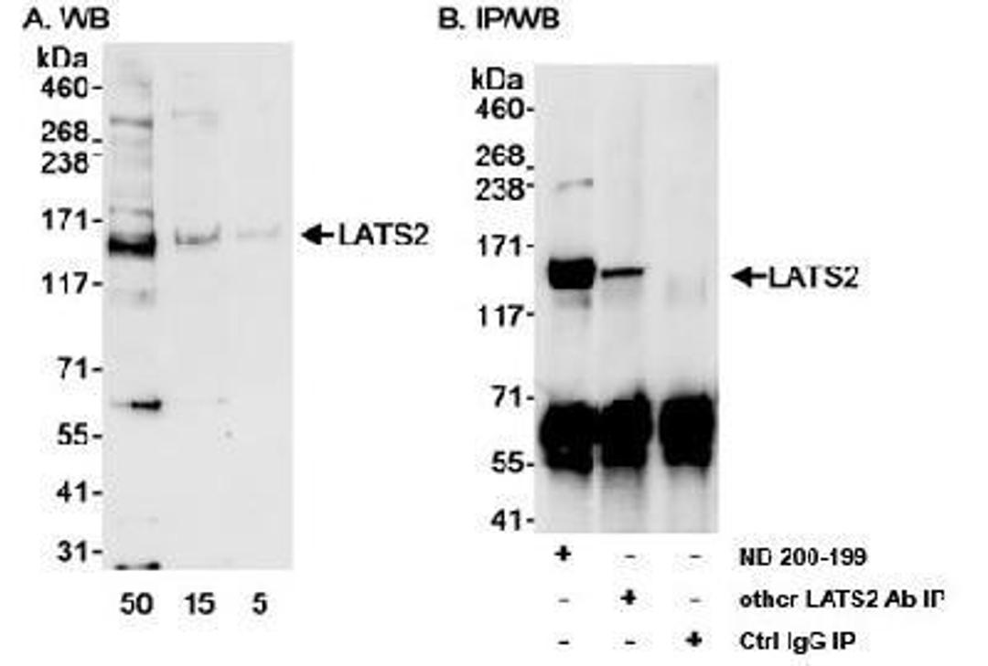 Western Blot: LATS2 Antibody [NB200-199] - Detection of Human LATS2 on HeLa whole cell lysate using NB200-199. LATS2 was also immunoprecipitated by another LATS2 antibody.