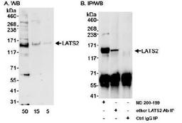 Western Blot: LATS2 Antibody [NB200-199] - Detection of Human LATS2 on HeLa whole cell lysate using NB200-199. LATS2 was also immunoprecipitated by another LATS2 antibody.