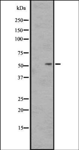 Western blot analysis of HEK293 cells using SS2R antibody