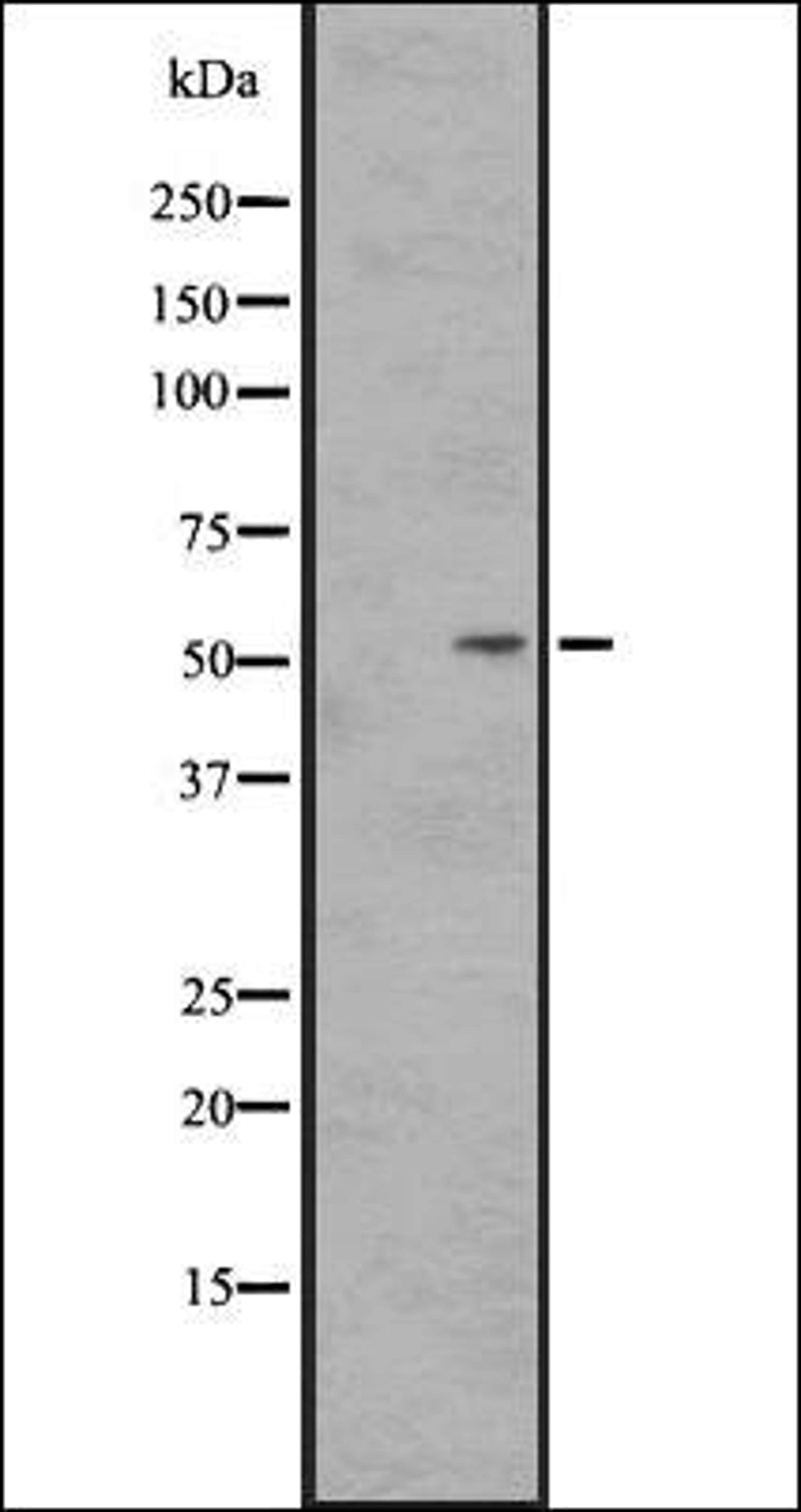 Western blot analysis of HEK293 cells using SS2R antibody