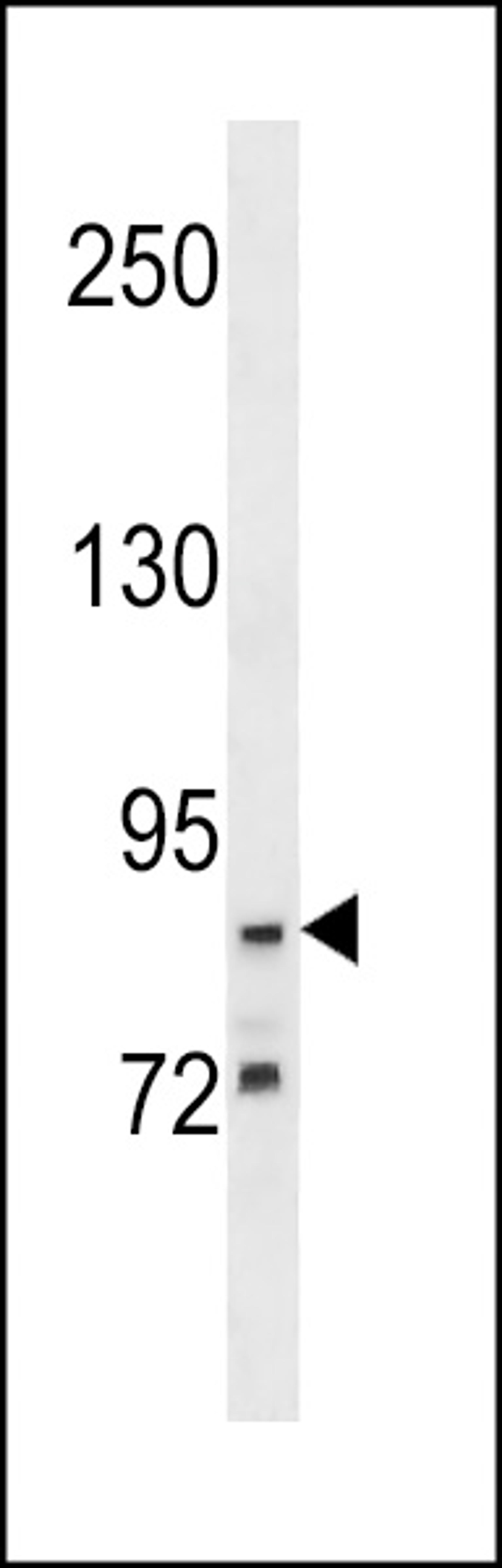 Western blot analysis in A549 cell line lysates (35ug/lane).