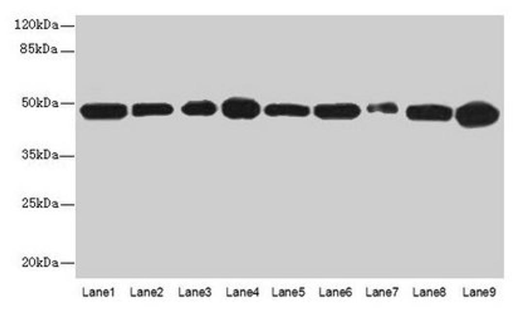 Western blot. All lanes: GOT2 antibody at 3µg/ml. Lane 1: A431 whole cell lysate. Lane 2: HepG2 whole cell lysate. Lane 3: Mouse muscle tissue . Lane 4: Mouse spleen tissue. Lane 5: MCF-7 whole cell lysate. Lane 6: Hela whole cell lysate. Lane 7: LO2 whole cell lysate. Lane 8: 293T whole cell lysate. Lane 9: HL60 whole cell lysate. Secondary. Goat polyclonal to rabbit IgG at 1/10000 dilution. Predicted band size: 48, 44 kDa. Observed band size: 48 kDa