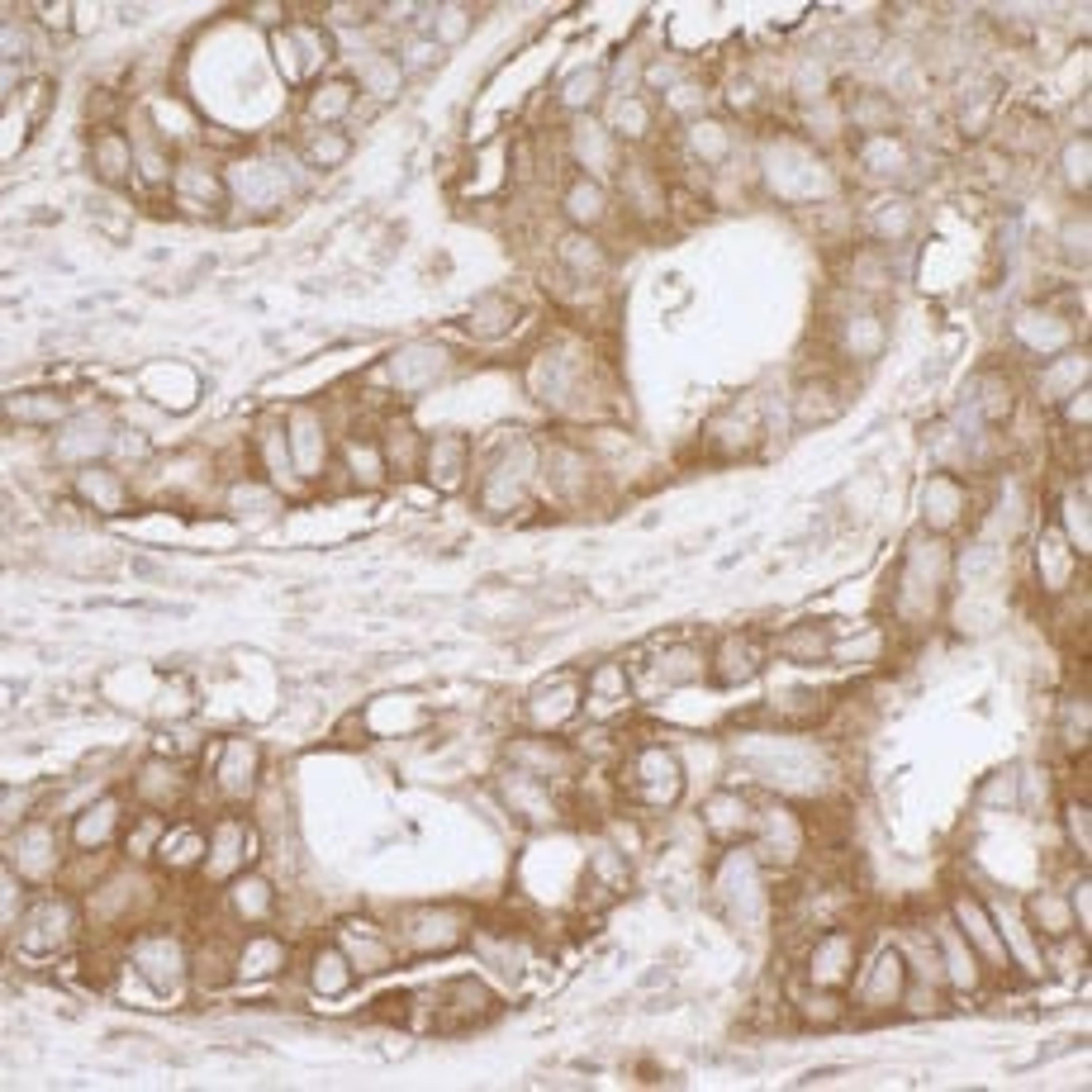 Detection of human MVP by immunohistochemistry.