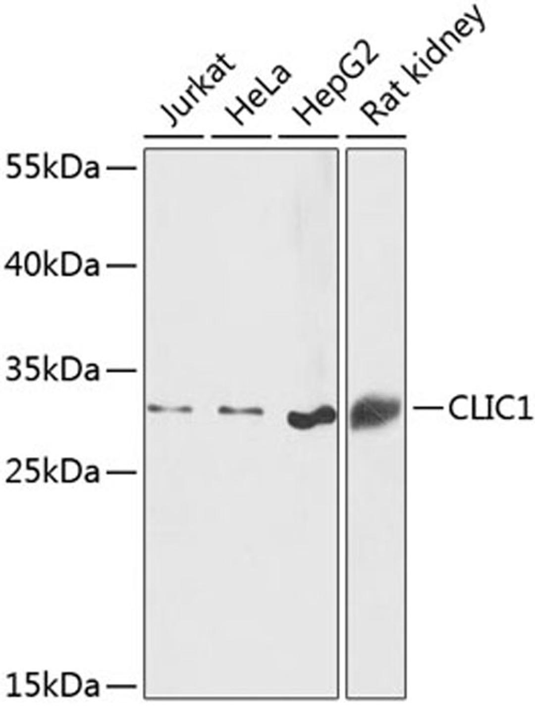 Western blot - CLIC1 antibody (A13684)