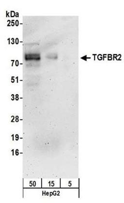 Detection of human TGFBR2 by western blot.