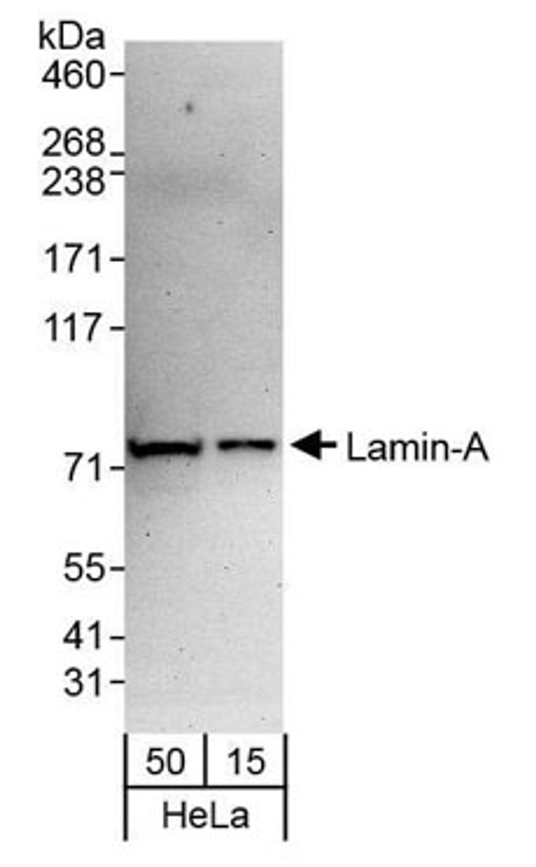 Detection of human Lamin-A by western blot.