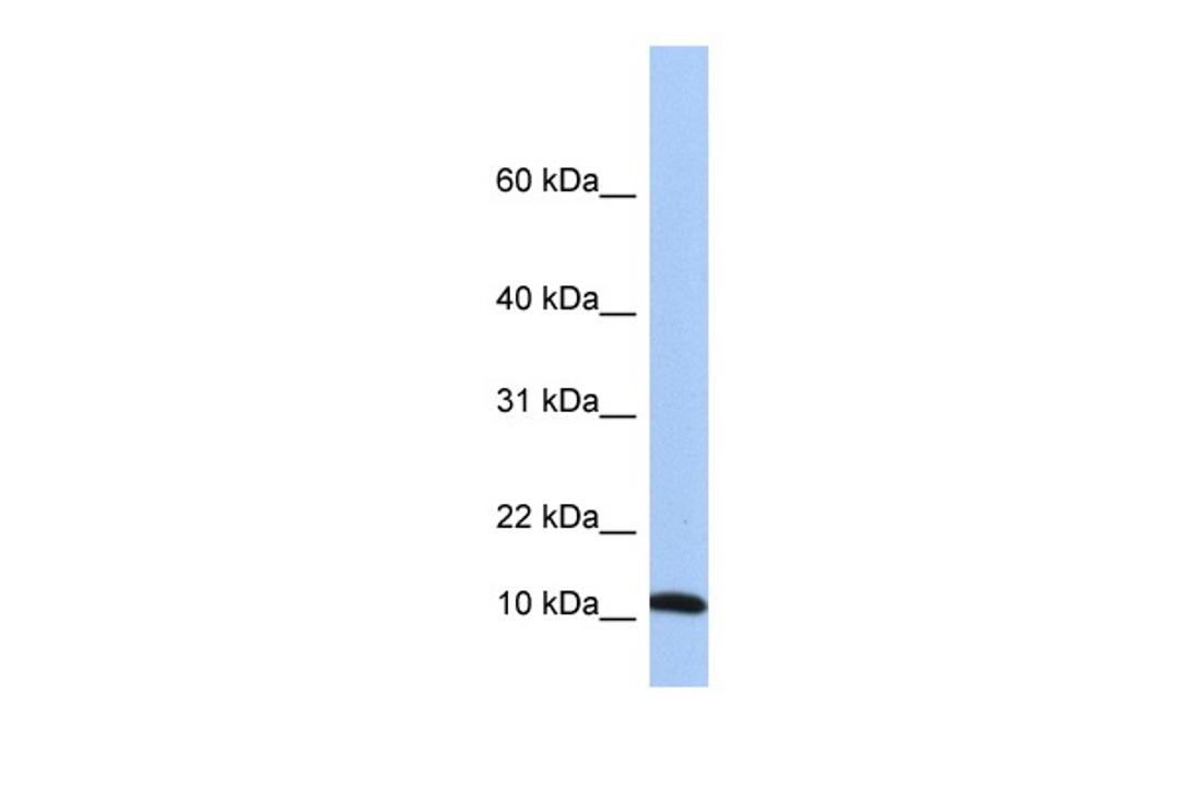 Antibody used in WB on Human 721_B at 0.2-1 ug/ml.