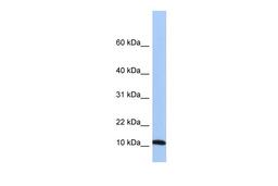 Antibody used in WB on Human 721_B at 0.2-1 ug/ml.