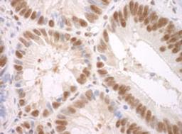 Detection of human SF3A3 by immunohistochemistry.