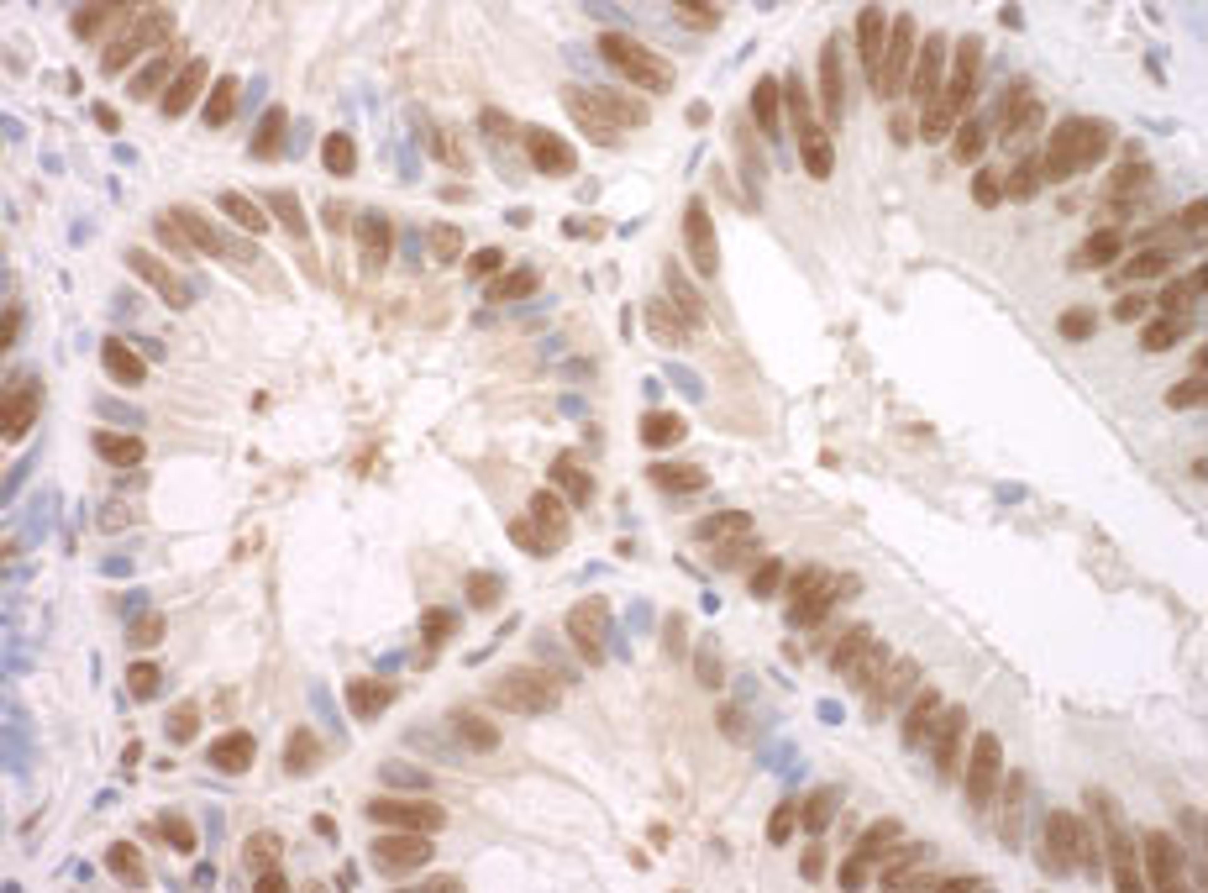 Detection of human SF3A3 by immunohistochemistry.