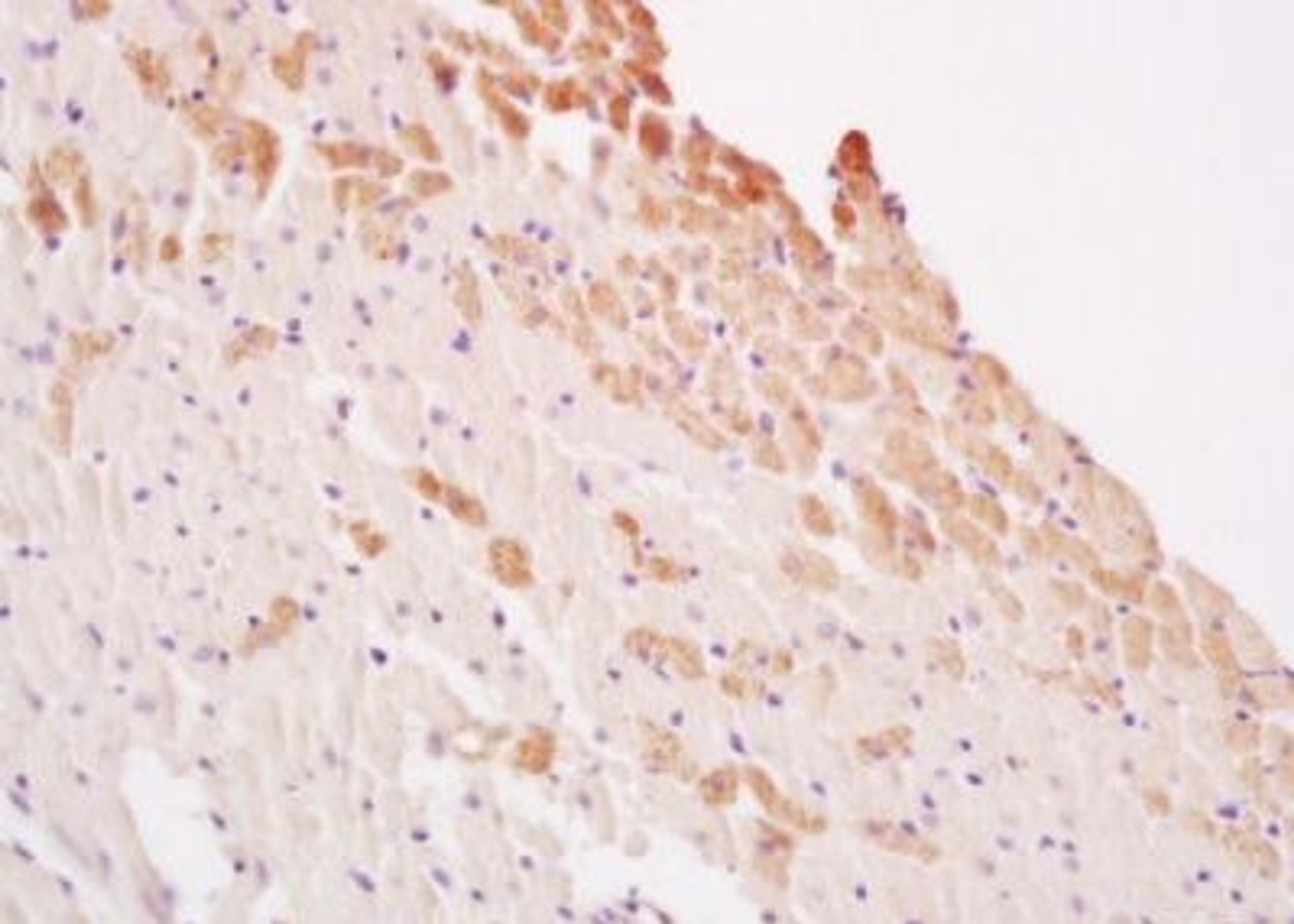 Immunohistochemical analysis of formalin-fixed paraffin embedded rat heart tissue using LATS2 antibody (dilution at 1:200)