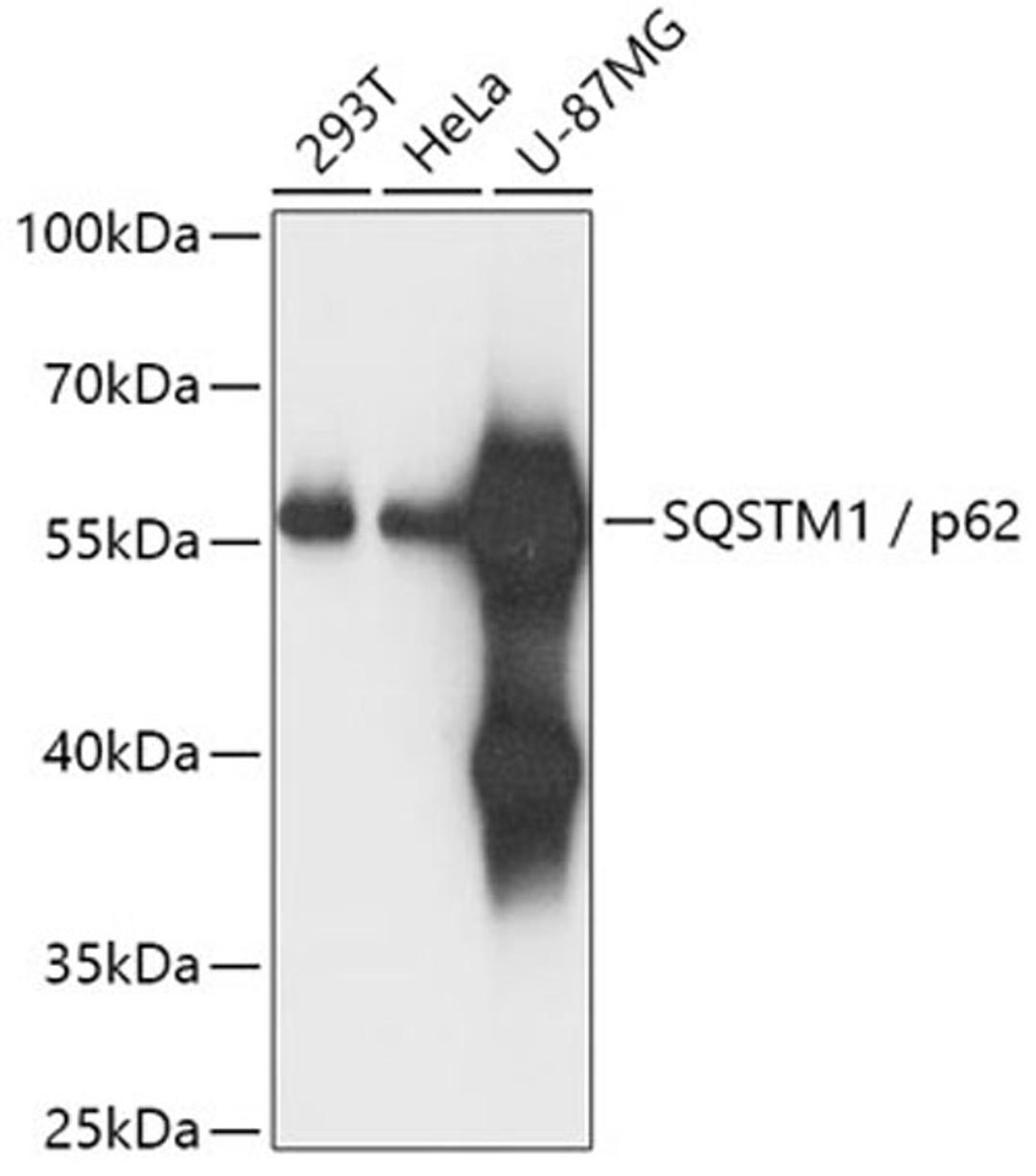 Western blot - SQSTM1 antibody (A11483)