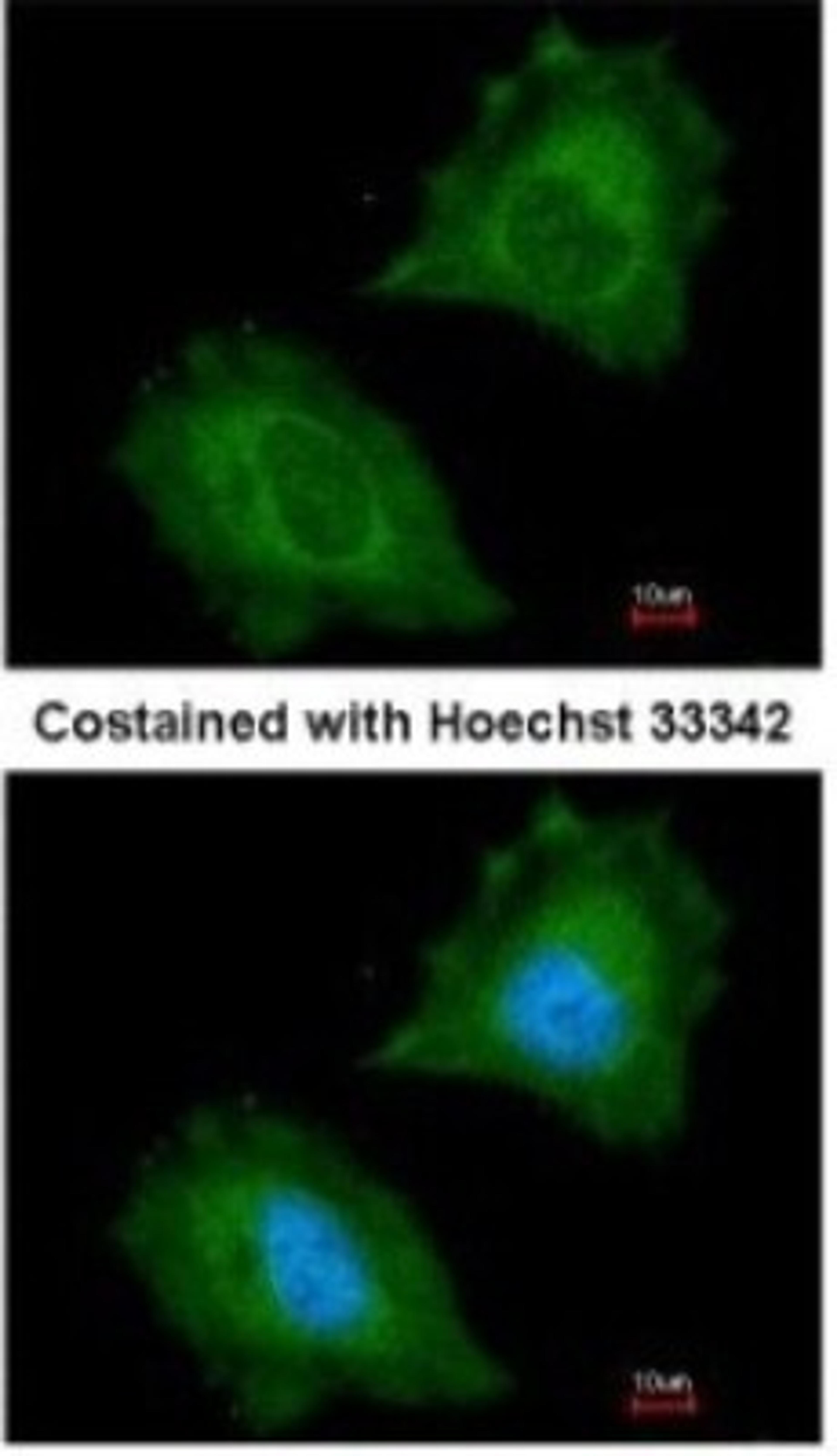 Immunocytochemistry/Immunofluorescence: ASPA Antibody [NBP1-31754] - Paraformaldehyde-fixed HeLa, using antibody at 1:200 dilution.