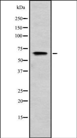 Western blot analysis of HEK293 cells using RIOK2 antibody