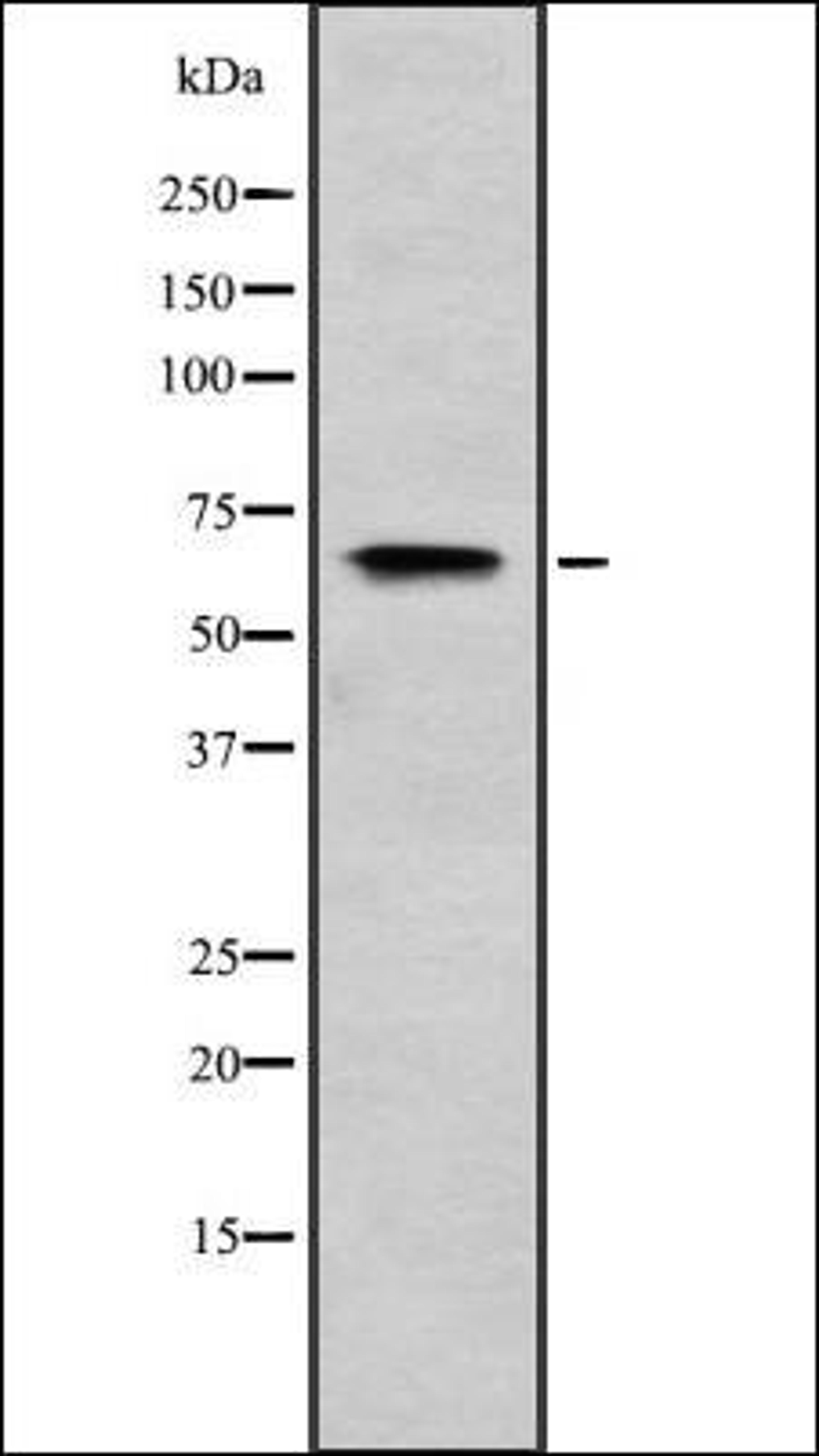 Western blot analysis of HEK293 cells using RIOK2 antibody