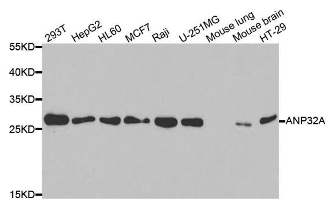 Western blot analysis of extracts of various cell lines using ANP32A antibody