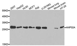 Western blot analysis of extracts of various cell lines using ANP32A antibody