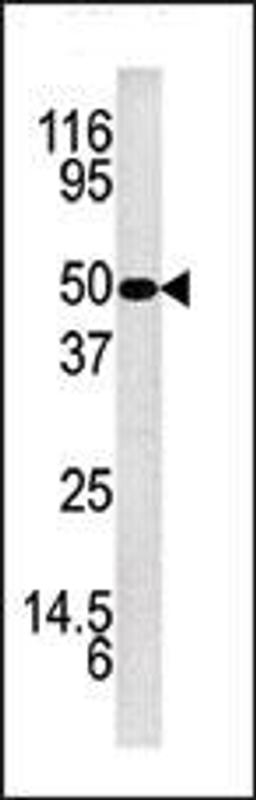 Western blot analysis of anti-KLK5 Pab in mouse brain tissue lysate