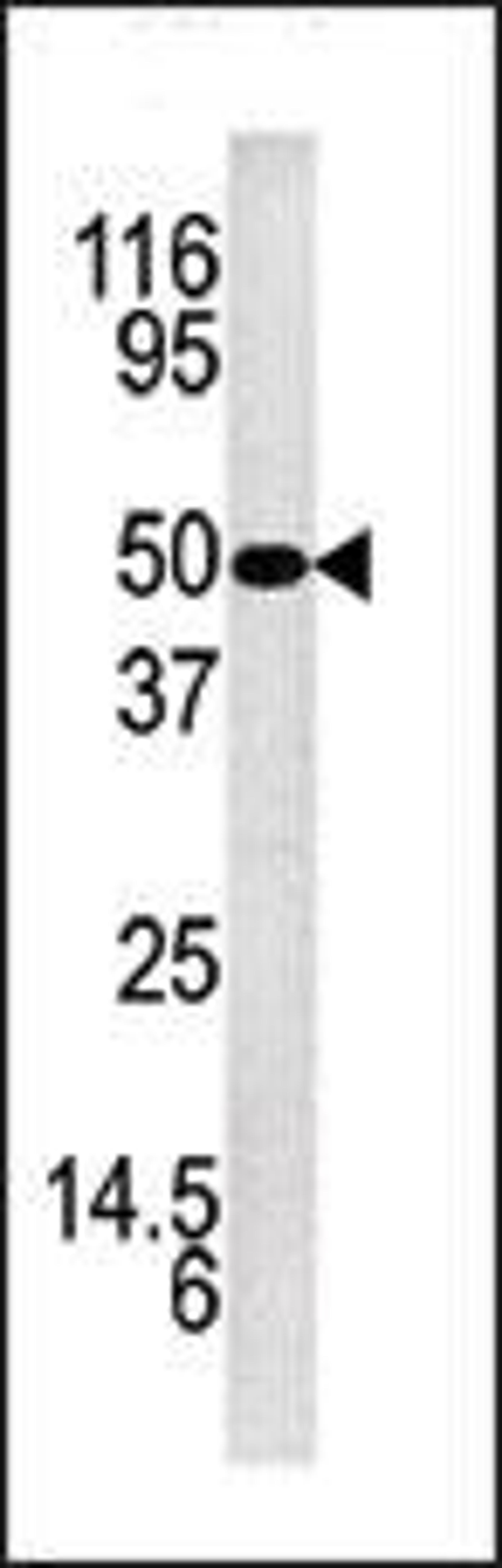 Western blot analysis of anti-KLK5 Pab in mouse brain tissue lysate