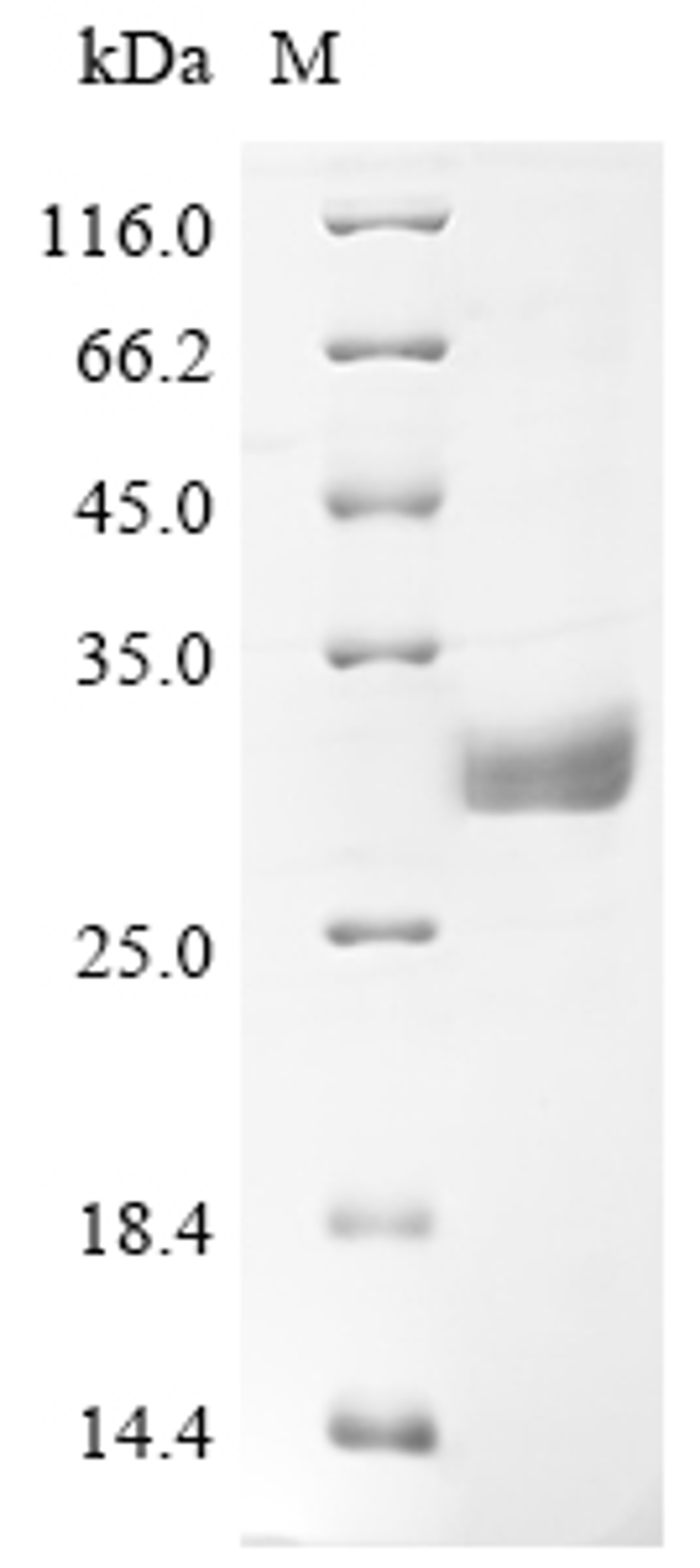 (Tris-Glycine gel) Discontinuous SDS-PAGE (reduced) with 5% enrichment gel and 15% separation gel.