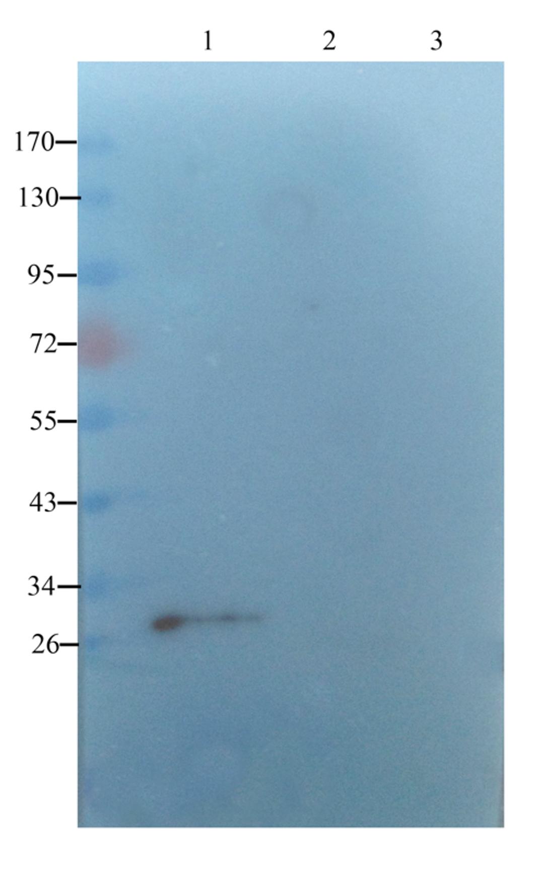 WB analysis of rar uterus (lane 1),rat ovary (lane 2),rat thyriod (lane 3) using SERPING1 antibody (1 ug/ml)